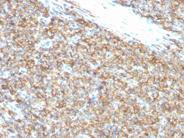 CD99 Antibody in Immunohistochemistry (IHC (P))