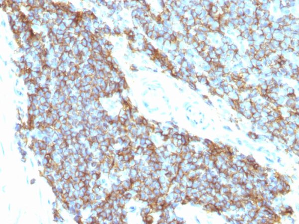 CD99 / MIC2 (Ewing&apos;s Sarcoma Marker) Antibody