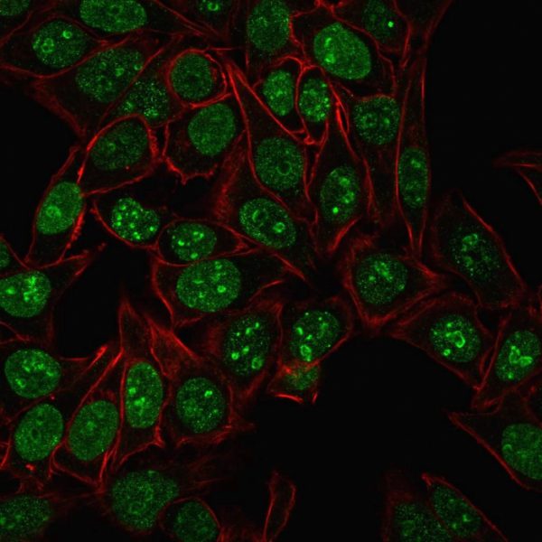 Ki-67 (Proliferating Cell Marker) Antibody - Image 2