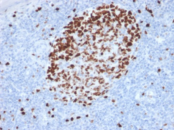 Ki-67 (Proliferating Cell Marker) Antibody