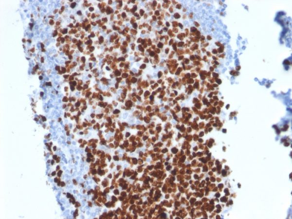 Ki-67 (Proliferating Cell Marker) Antibody - Image 2