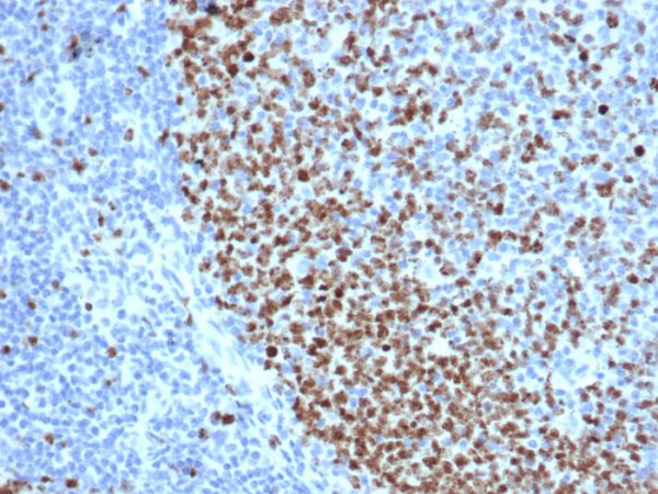 Formalin-fixed, paraffin-embedded human tonsil stained with Ki67 Recombinant Mouse Monoclonal Antibody (rMKI67/6615).