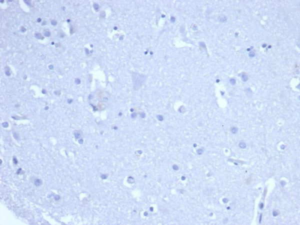 IHC analysis of formalin-fixed, paraffin-embedded human brain. Negative tissue control using rMKI67/6615 at 2ug/ml in PBS for 30min RT. HIER: Tris/EDTA, pH9.0, 45min. 2°C: HRP-polymer, 30min. DAB, 5min.