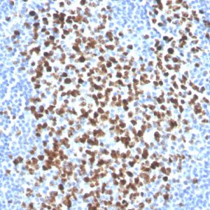 Ki-67 Antibody in Immunohistochemistry (IHC (P))