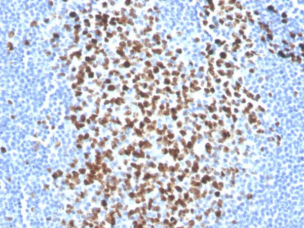 Ki-67 Antibody in Immunohistochemistry (IHC (P))