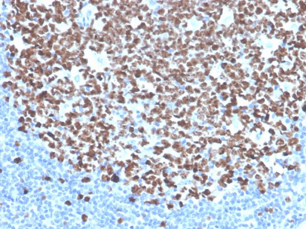 Recombinant Ki-67 (Proliferating Cell Marker) Antibody - Image 2