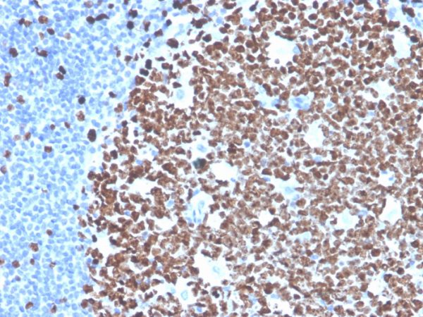 Recombinant Ki-67 (Proliferating Cell Marker) Antibody - Image 3