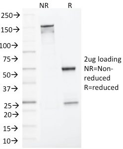 SDS-PAGE Analysis of Purified MLH1 Mouse Monoclonal Antibody (MLH1/1324). Confirmation of Integrity and Purity of Antibody