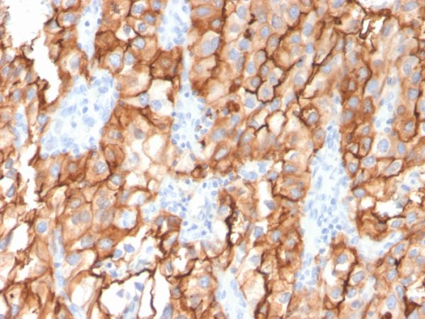 CD10 (Membrane Metalloendopeptidase) Antibody