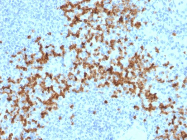 Formalin-fixed, paraffin-embedded human Spleen stained with MMP9 Mouse Monoclonal Antibody (2C3).