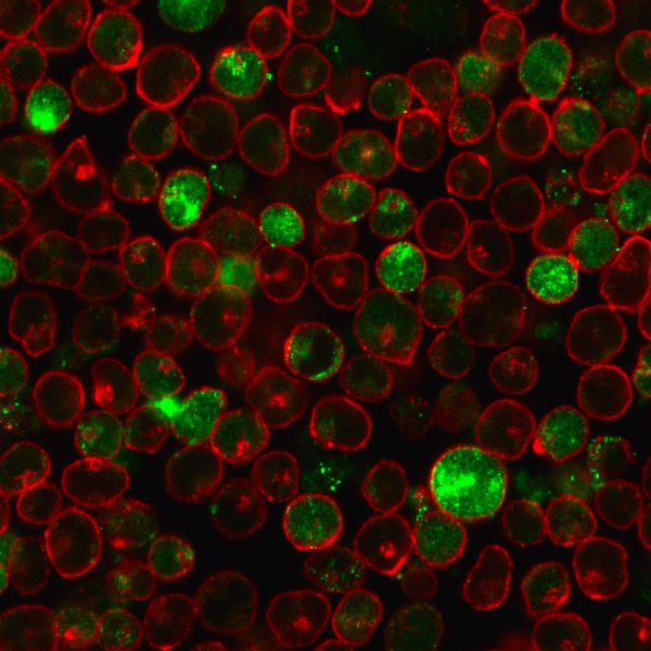 Immunofluorescence staining of MOLT-4 cells using MSH2 Mouse Monoclonal Antibody (MSH2/2622) followed by goat anti-mouse IgG conjugated to CF488 (green). Membrane are stained with Phalloiden (Red).