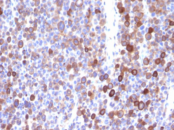 Moesin Antibody - Image 2