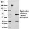 MTAP (Tumor Suppressor Marker) Antibody - Image 2