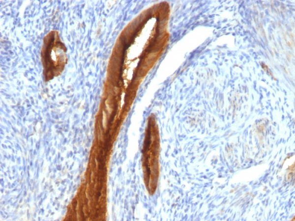 MUC1 / CA15-3 / EMA / CD227 (Epithelial Marker) Antibody - Image 4