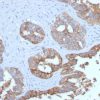 Recombinant MUC1 / CA15-3 / EMA / CD227 (Epithelial Marker) Antibody