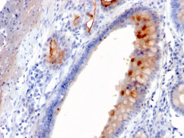 MUC4 (Mucin 4 / Gastric Mucin) Antibody - Image 3