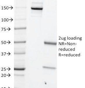 SDS-PAGE Analysis of Purified MYC Mouse Monoclonal Antibody (MYC699). Confirmation of Integrity and Purity of Antibody.