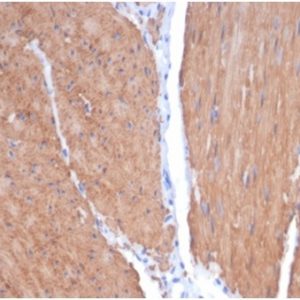 Formalin-fixed, paraffin-embedded human smooth muscle stained with SM-MHC Recombinant Rabbit Monoclonal Antibody (MYH11/7087R). HIER: Tris/EDTA, pH9.0, 45min. 2°C: HRP-polymer, 30min. DAB, 5min.