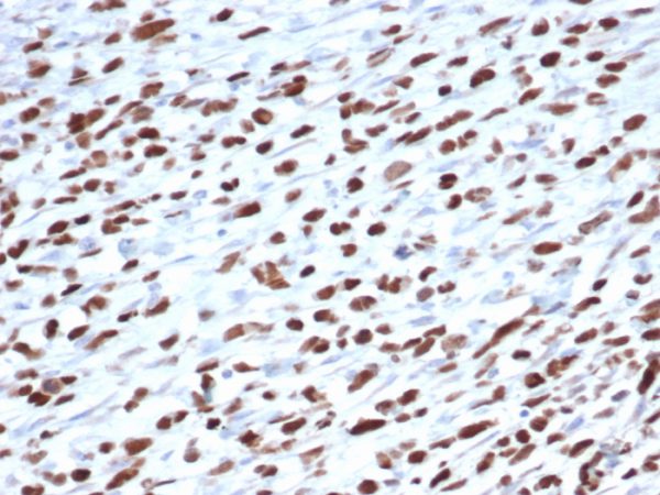 MyoD1 (Rhabdomyosarcoma Marker) Antibody