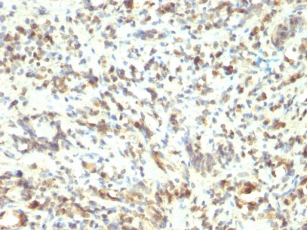 MyoD1 (Rhabdomyosarcoma Marker) Antibody - Image 3