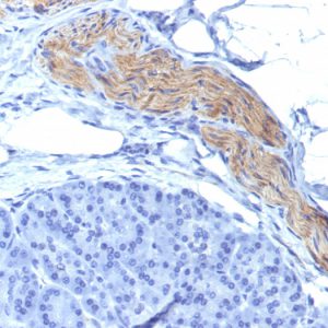 Formalin-fixed, paraffin-embedded human Pancreas stained with CD56 Mouse Monoclonal Antibody (NCAM1/795).