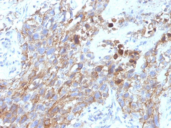 CD56 / NCAM1 / NKH1 (Neuronal Cell Marker) Antibody - Image 2