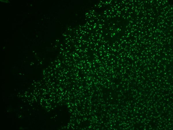 Nucleolin Antibody in Immunofluorescence (IF)