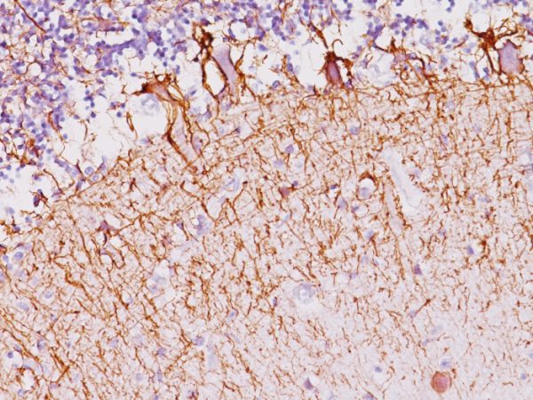 Formalin-fixed, paraffin-embedded human Cerebellum stained with Neurofilament Mouse Monoclonal Antibody (NF421).