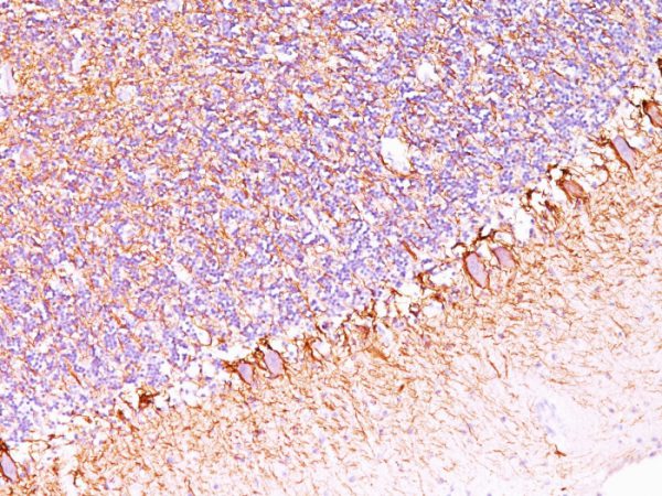 Formalin-fixed, paraffin-embedded human Cerebellum stained with Neurofilament Monoclonal Antibody (SPM563).