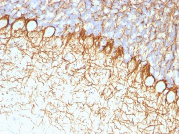 Formalin-fixed, paraffin-embedded Rat Cerebellum stained with Neurofilament Monoclonal Antibody (RT-97).