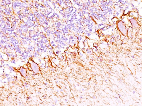 Neurofilament (NF-H) (Neuronal Marker) Antibody