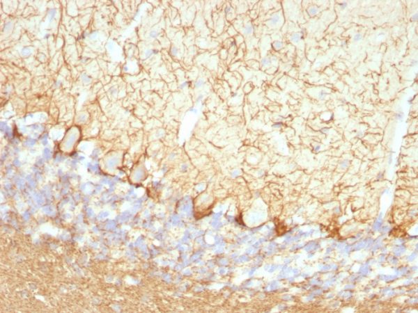 Neurofilament (NF-L) (Neuronal Marker) Antibody