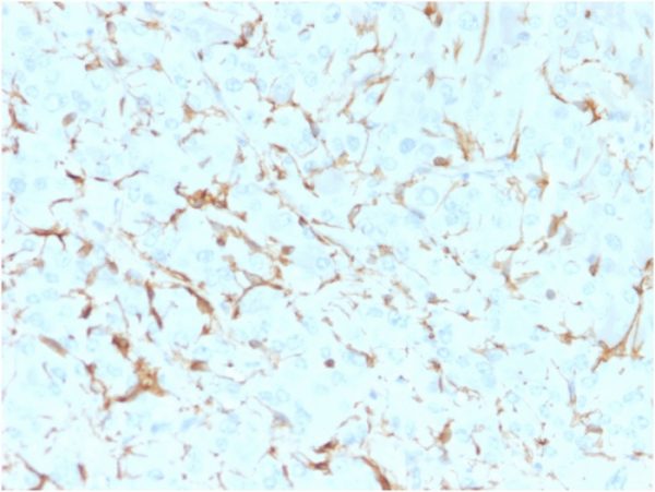 NGF-Receptor (p75) / CD271 (Soft Tissue Tumor Marker) Antibody - Image 2