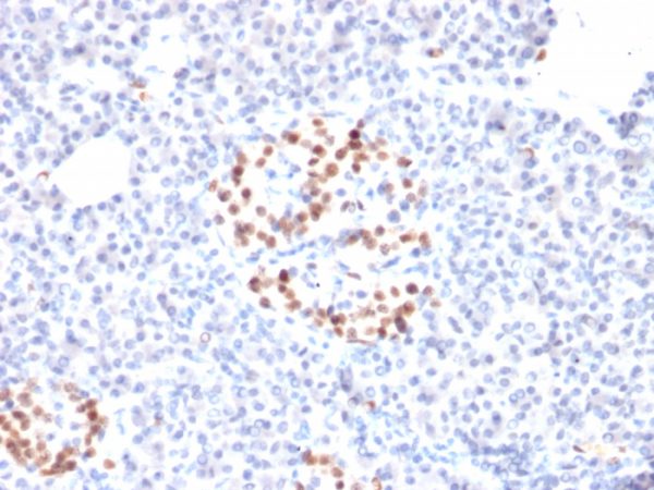 Formalin-fixed, paraffin-embedded human Pancreas stained with NKX6.1 Mouse Monoclonal Antibody (NKX61/2561).