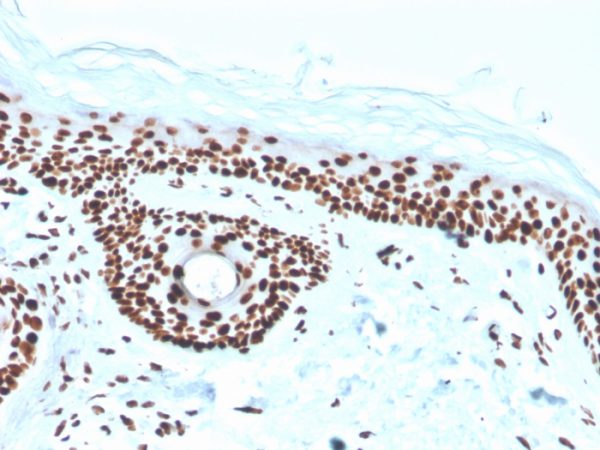 Formalin-fixed, paraffin-embedded human skin stained with Nucleophosmin Recombinant Mouse Monoclonal Antibody (rNPM1/1901).