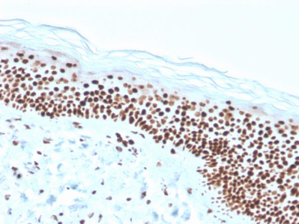 Formalin-fixed, paraffin-embedded human skin stained with Nucleophosmin Recombinant Mouse Monoclonal Antibody (rNPM1/1901).