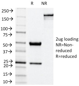 SDS-PAGE Analysis of Purified NOX4 Mouse Monoclonal Antibody (NOX4/1245). Confirmation of Integrity and Purity of Antibody