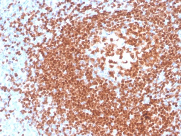 Formalin-fixed, paraffin-embedded human tonsil stained with PAX5 Recombinant Mouse Monoclonal Antibody (rPAX5/4228).