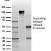 PBX1 / PRL (Transcription Factor) Antibody