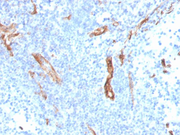 Formalin-fixed, paraffin-embedded human prostate stained with CD31 Mouse Monoclonal Antibody (PECAM1/3527).
