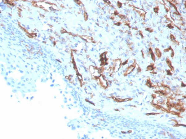 Formalin-fixed, paraffin-embedded human tonsil stained with CD31 Mouse Monoclonal Antibody (PECAM1/3529).