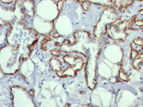 CD31 Antibody in Immunohistochemistry (IHC (P))