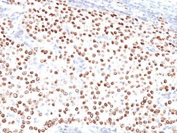 Progesterone Receptor (Marker of Progestin Dependence) Antibody