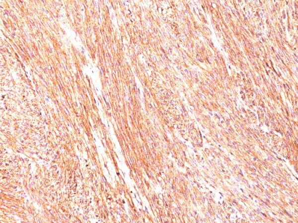 DOG-1 Antibody in Immunohistochemistry (IHC (P))