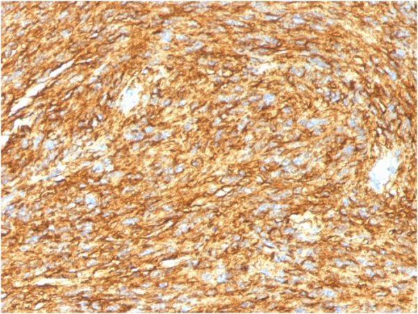 DOG-1 / TMEM16A (Gastrointestinal Stromal Tumor Marker) Antibody