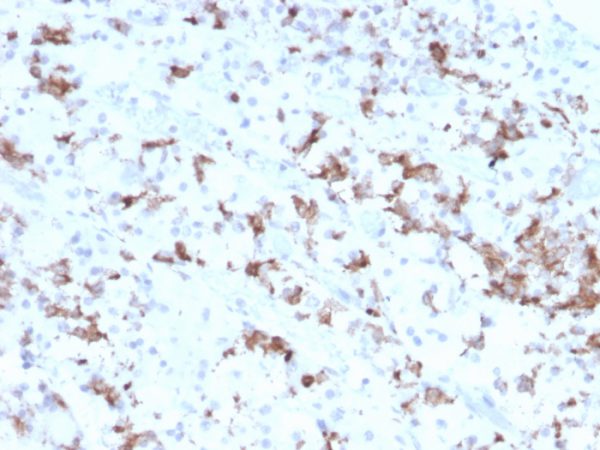 Formalin-fixed, paraffin-embedded human Pituitary stained with Prolactin Mouse Monoclonal Antibody (PRL/2641).