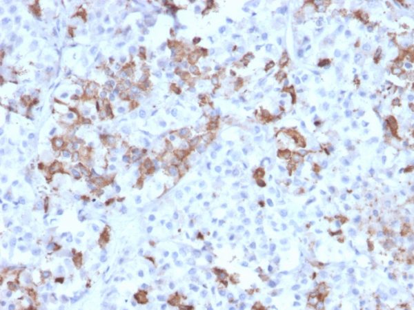 Formalin-fixed, paraffin-embedded human Pituitary stained with Prolactin Mouse Monoclonal Antibody (PRL/2642).