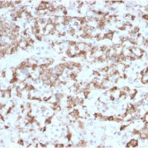 Formalin-fixed, paraffin-embedded human Pituitary stained with Prolactin Mouse Monoclonal Antibody (PRL/2910).