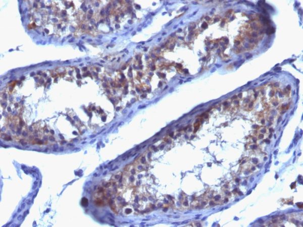 Prolactin Receptor (PRL-R) Antibody