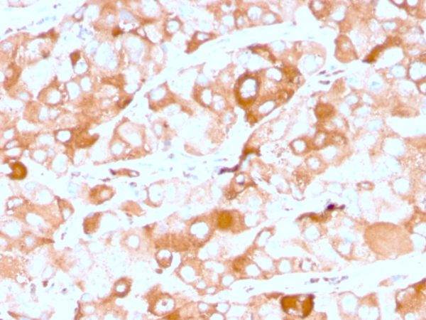 Recombinant Prolactin Receptor (hPRL Receptor) Antibody - Image 2